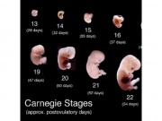 TREATMENT OF AZOO,OLIGOSPERMIA WITH IUI ,ICSI,IVF